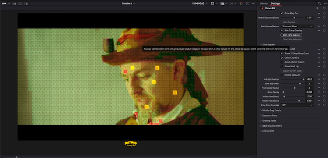 ZoneLAB Skintone Overlay Analyze